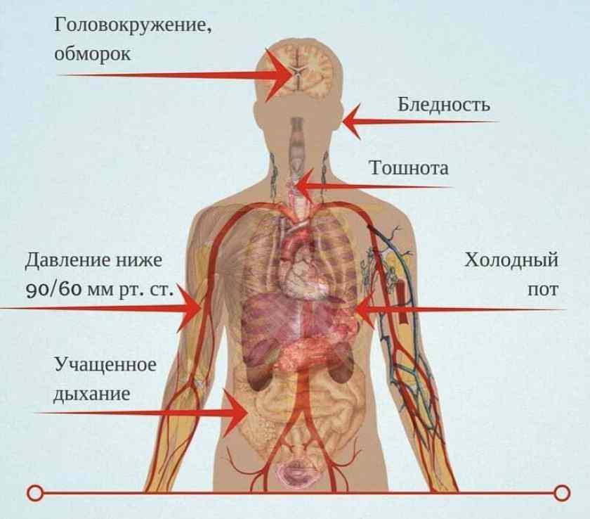 Пониженное давление